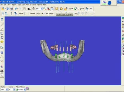 Pre-Op 3D (3)